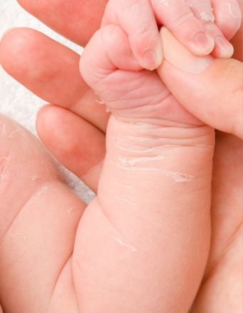 dry patches on baby skin